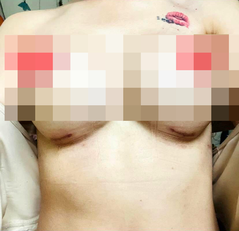 Hình ảnh sau phẫu thuật thẩm mỹ tại Bệnh viện Hồng Hà